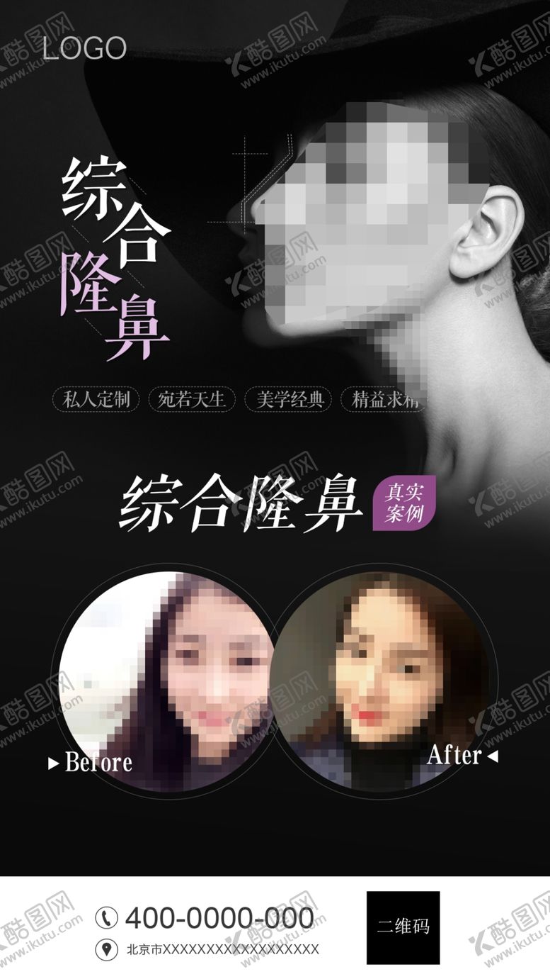 编号：88782607090401192266【酷图网】源文件下载-隆鼻
