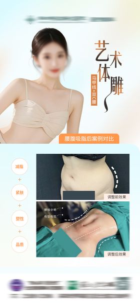 艺术体雕案列海报