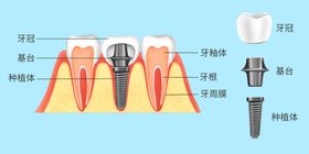 心理教育图解