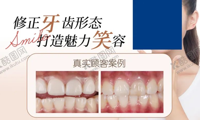 编号：14774212011145056436【酷图网】源文件下载-修复牙齿