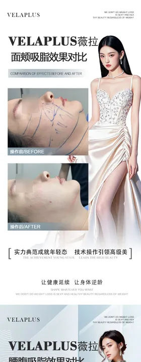 面颊腰腹吸脂案例