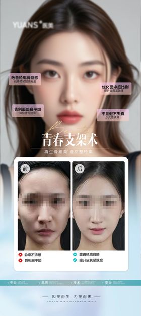 医美面部轮廓案例海报