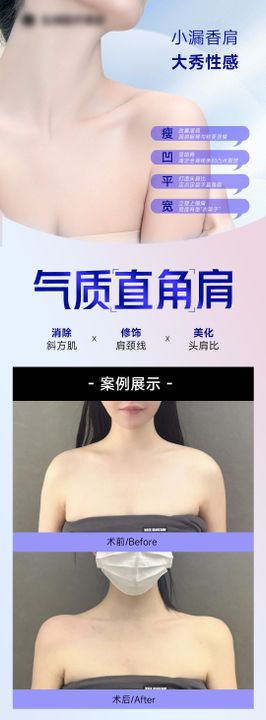 医美案例海报