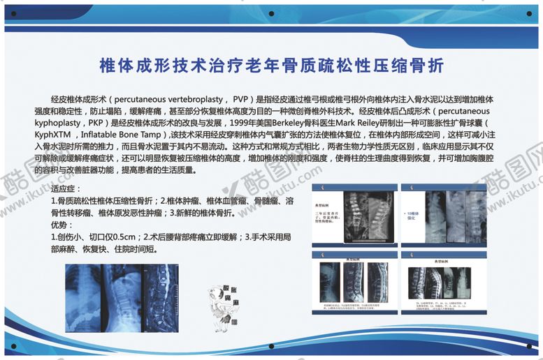 编号：37779202101351279872【酷图网】源文件下载-椎体成形治疗老年骨质增生展板