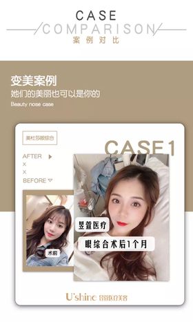 医美整形医院案例对比海报