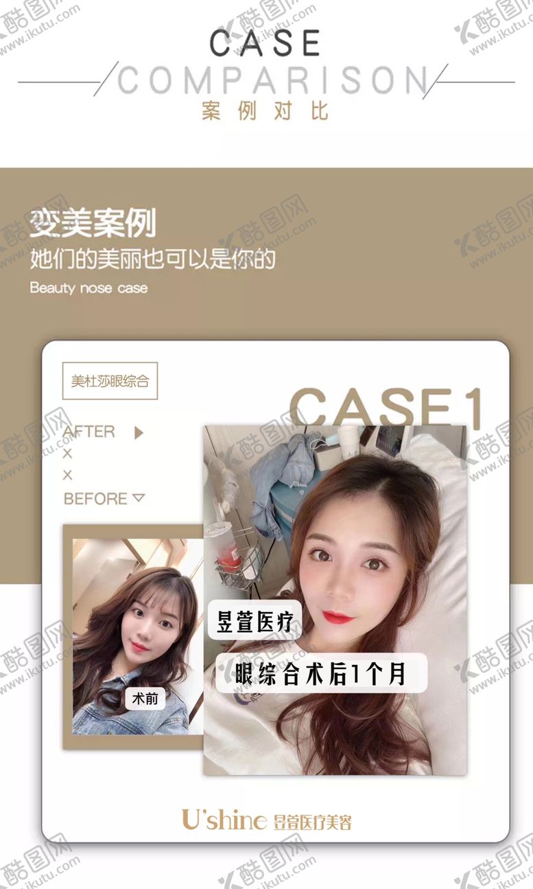 编号：98133707040103508552【酷图网】源文件下载-医美整形医院案例对比海报