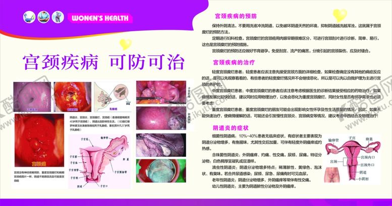 编号：43595207140158042543【酷图网】源文件下载-宫颈疾病可防可治