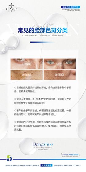 医美祛斑科普海报