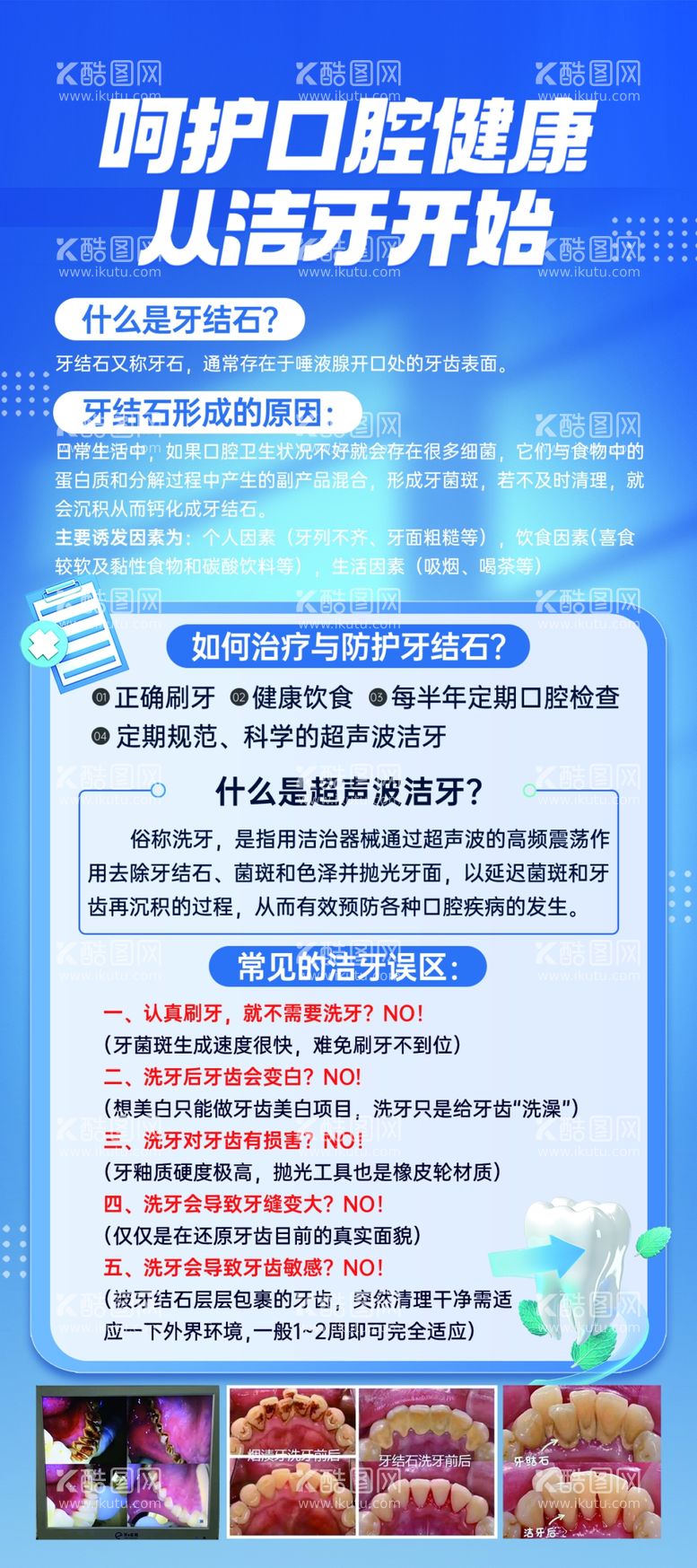 编号：13237311241738286045【酷图网】源文件下载-呵护口腔健康从洁牙开始