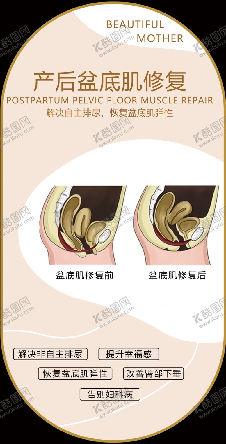 编号：79553002261747181077【酷图网】源文件下载-产后修复
