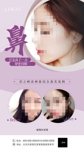 隆鼻系列海报