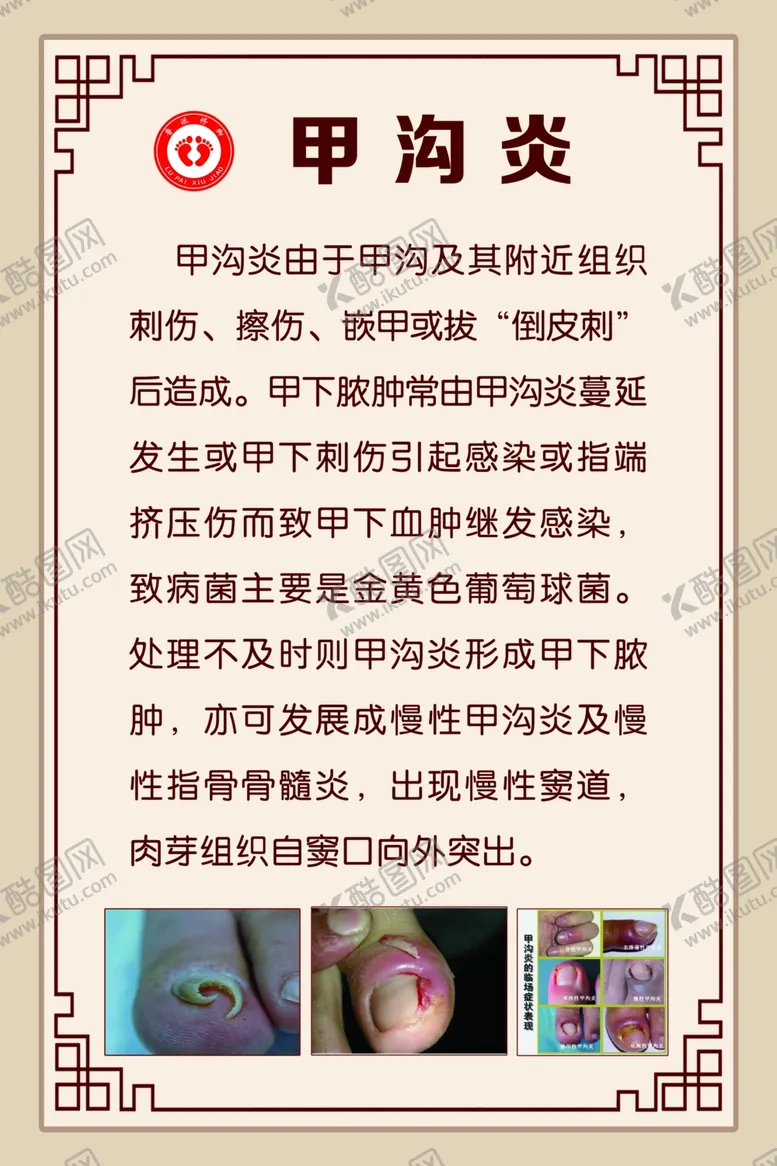 编号：55140605010907227231【酷图网】源文件下载-甲沟炎