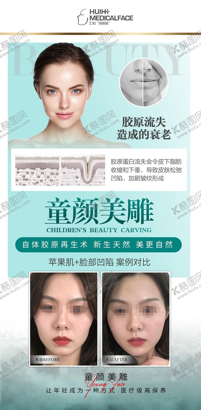 编号：33473603132106314382【酷图网】源文件下载-医美项目海报