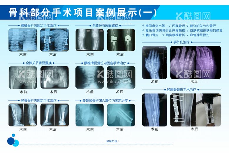 编号：92350610070424199175【酷图网】源文件下载-骨科部分手术项目案例展示