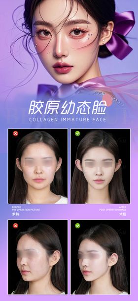 胶原幼态脸案例海报
