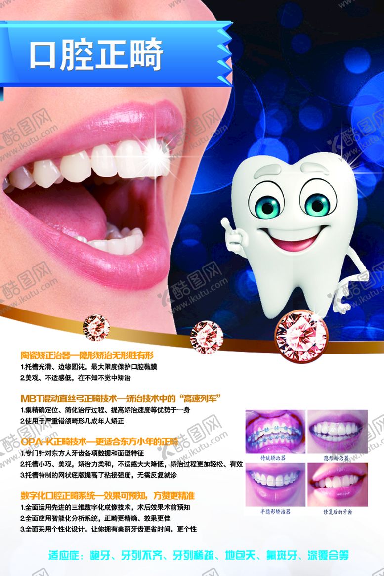 编号：98456109131018484028【酷图网】源文件下载-口腔正畸牙齿矫正隐形牙套