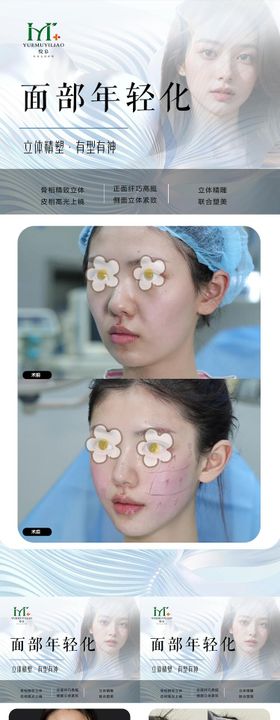 眼整形案例海报