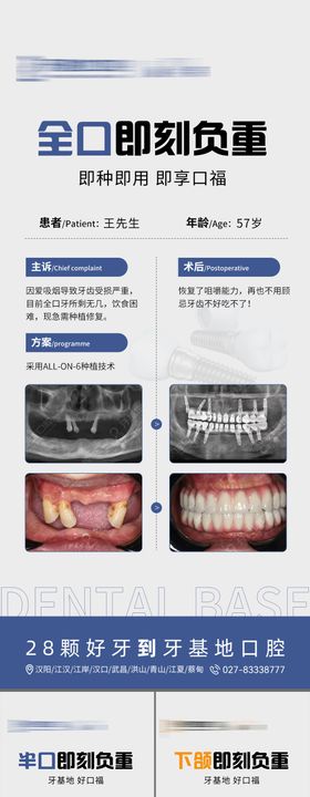 种植口腔专家案例海报长图