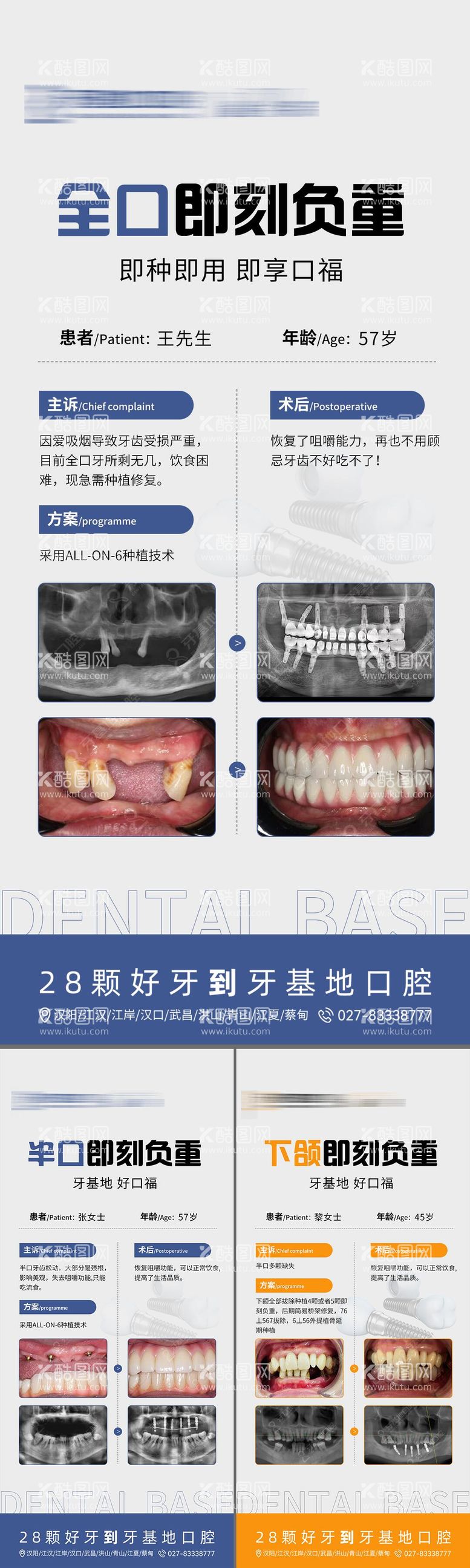 编号：46769212032259542070【酷图网】源文件下载-口腔种植案例海报