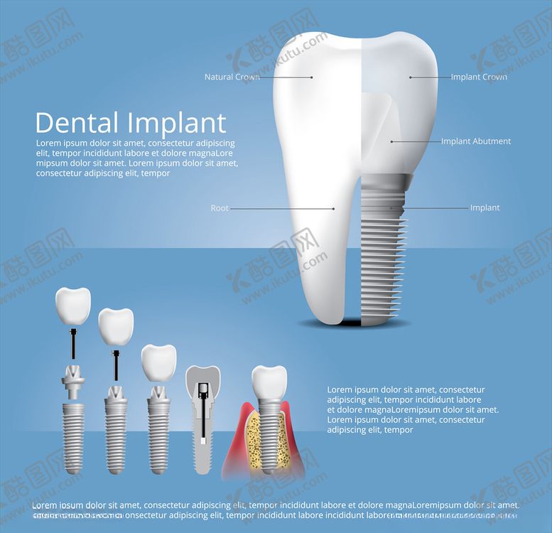 编号：73390910040910561177【酷图网】源文件下载-牙齿