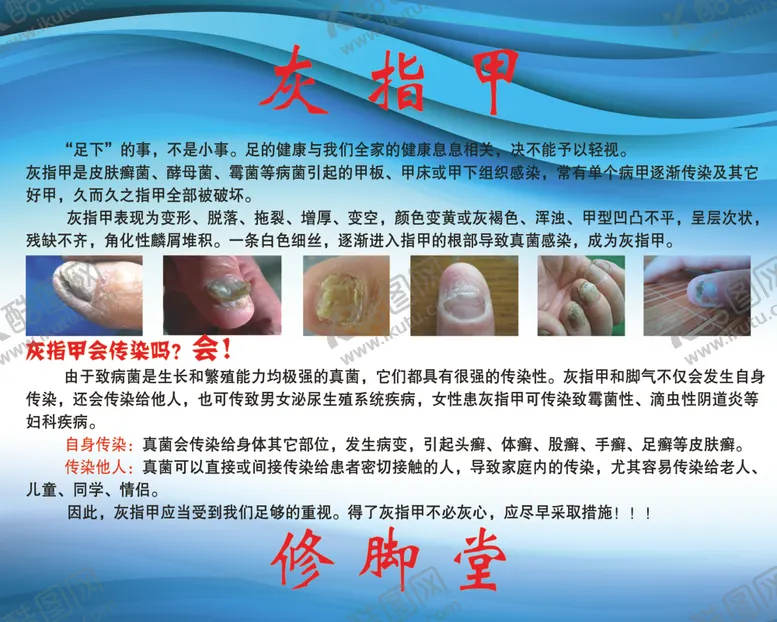 编号：50253906290825472376【酷图网】源文件下载-灰指甲