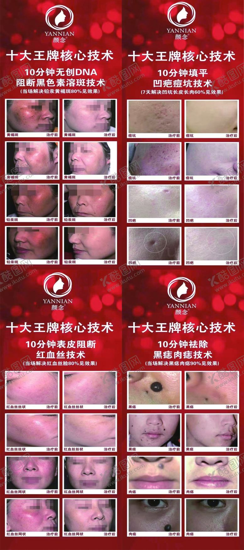 编号：67396812301407146231【酷图网】源文件下载-祛斑展架画面海报