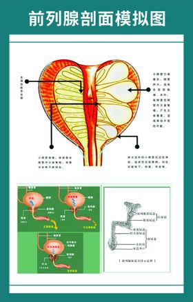 前列腺剖面图