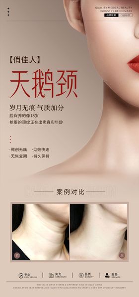 天鹅颈案例海报