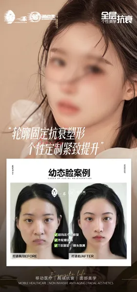 医美案例对比海报人物幼态脸整形容