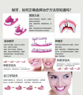 缺牙口腔知识海报