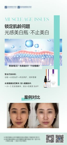医美胶原水光产品海报