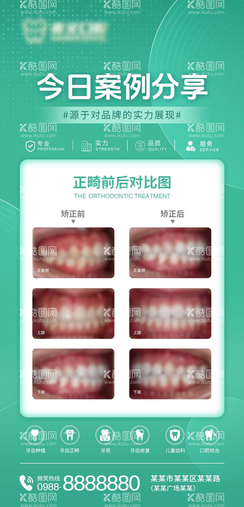 编号：93840211281047163310【酷图网】源文件下载-口腔正畸案例分享海报