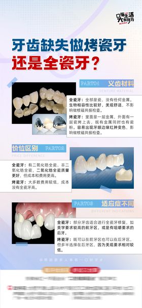 口腔科普之烤瓷牙与全瓷牙区别海报