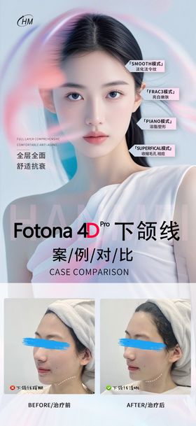 fotona4D案例对比