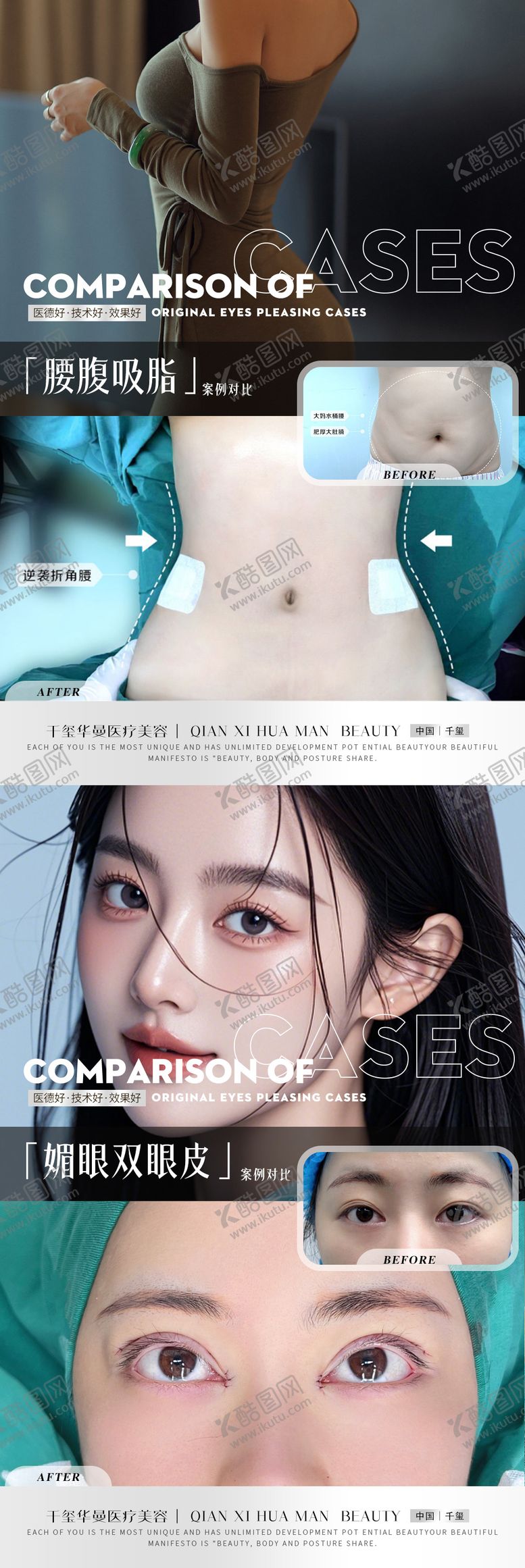 编号：80669508161241022313【酷图网】源文件下载-高级整形案例