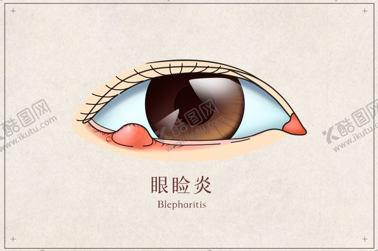 编号：27976801142040226598【酷图网】源文件下载-眼睑炎