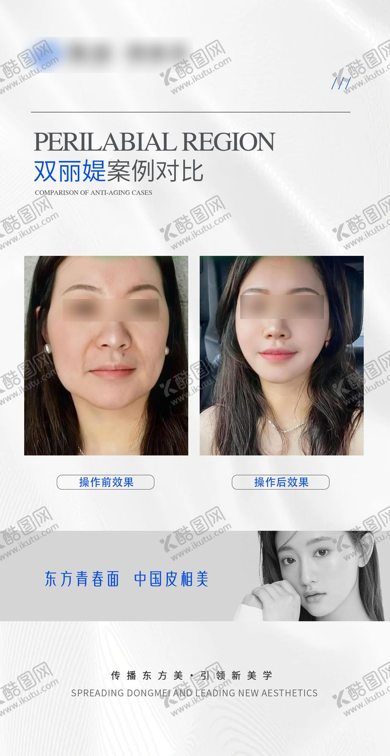 编号：84163605141433339933【酷图网】源文件下载-医美抗衰案例对比海报