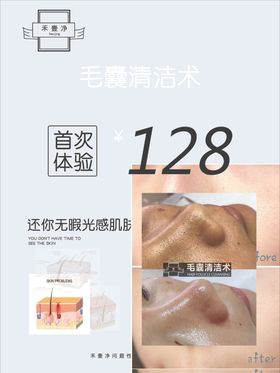 毛囊清洁术