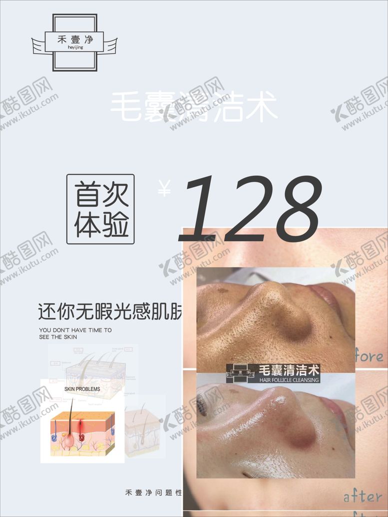 编号：42430505112121383583【酷图网】源文件下载-毛囊清洁术