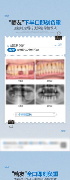 医疗口腔案例对比海报