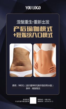 祛除妊娠纹