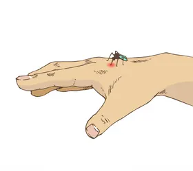 蚊子