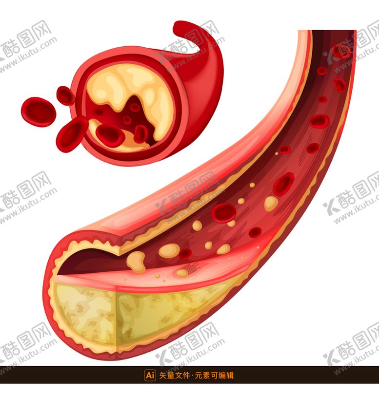 编号：73298510020845418137【酷图网】源文件下载-血管结构医学插画