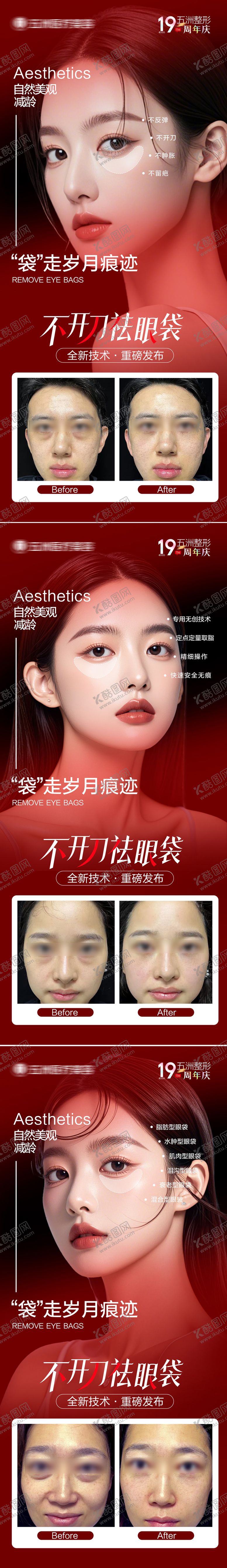 编号：24317712311241273891【酷图网】源文件下载-祛眼袋案例