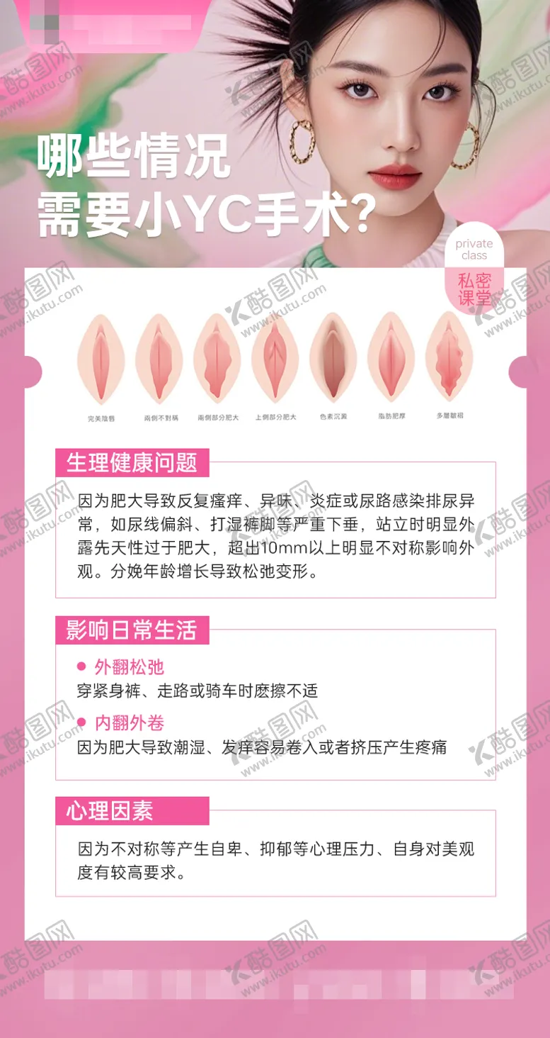 编号：85545411032016508078【酷图网】源文件下载-哪些情况需要小YC手术