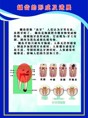 儿童蛀牙0龋齿