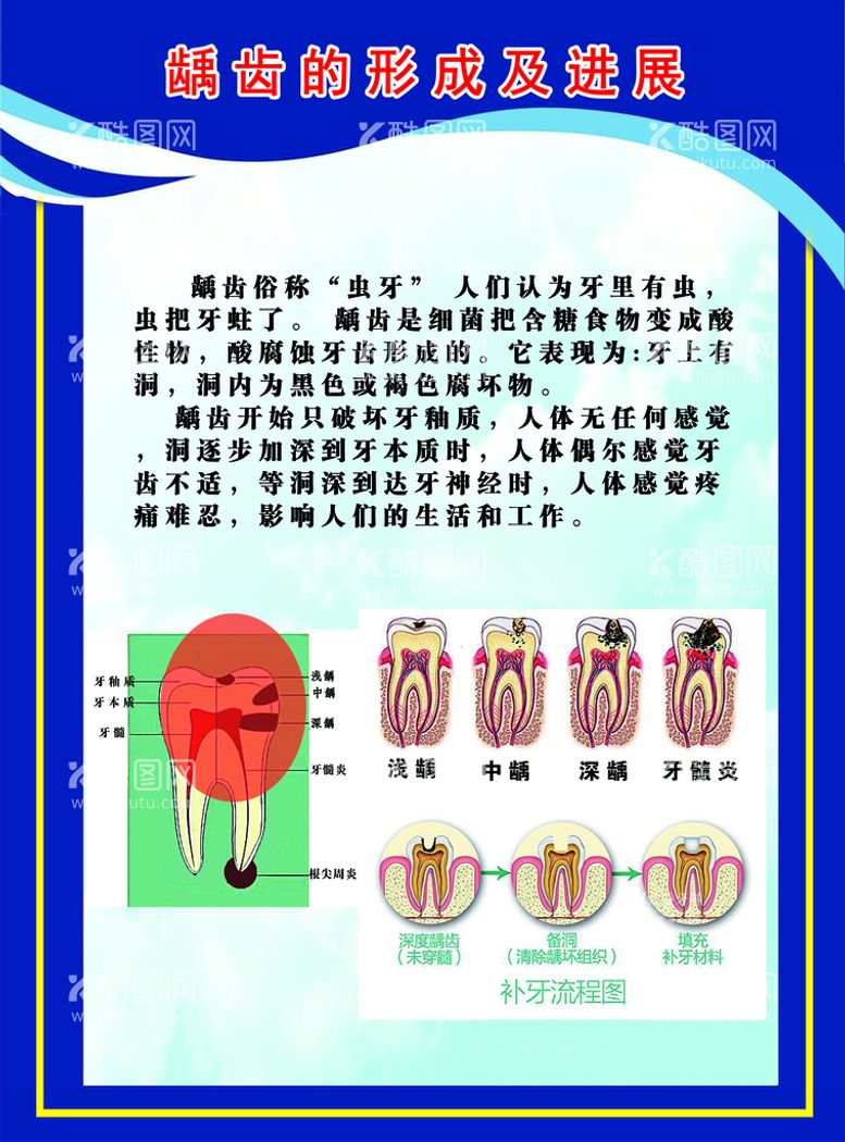 编号：72618509241700044180【酷图网】源文件下载-口腔 牙齿 龋齿形成