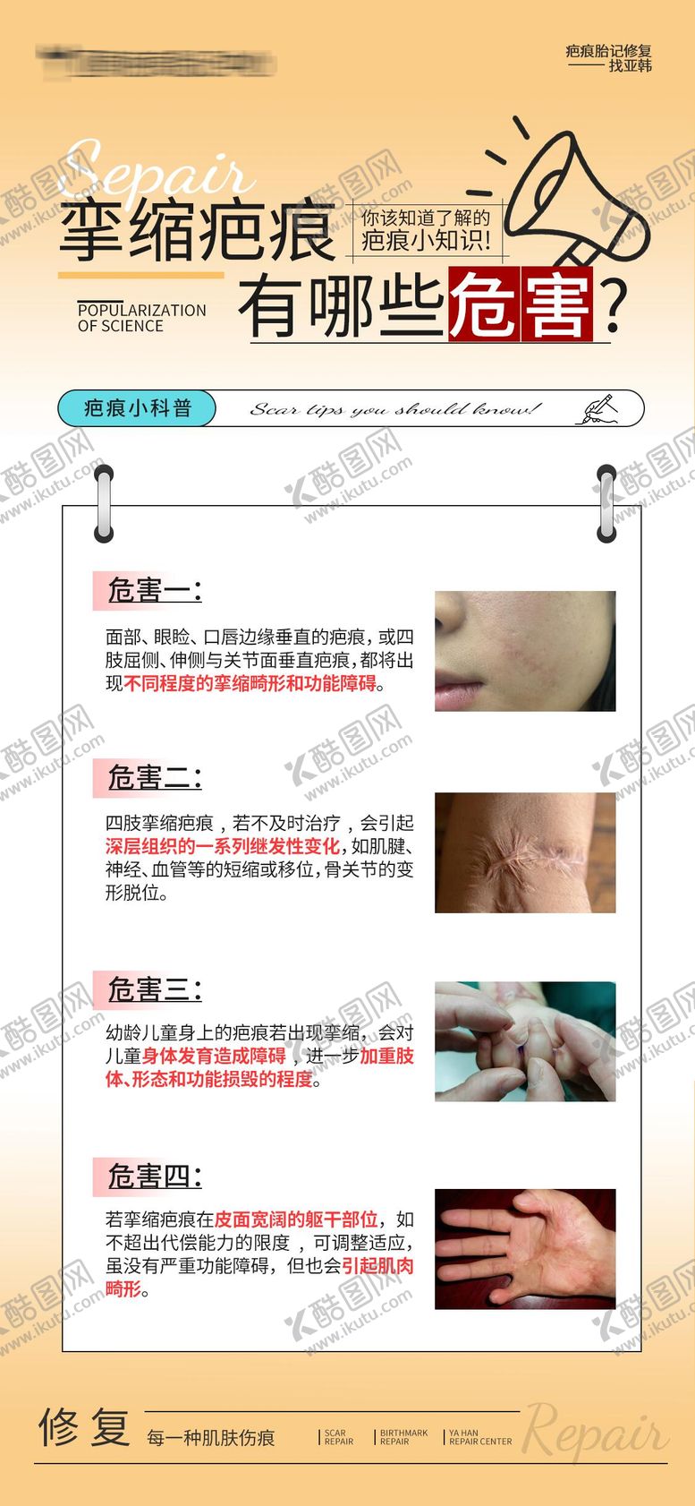 编号：73884808290908482033【酷图网】源文件下载-挛缩疤痕有哪些危害