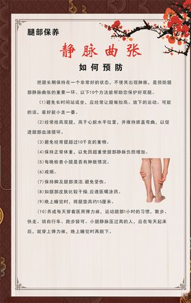 静脉曲张的预防
