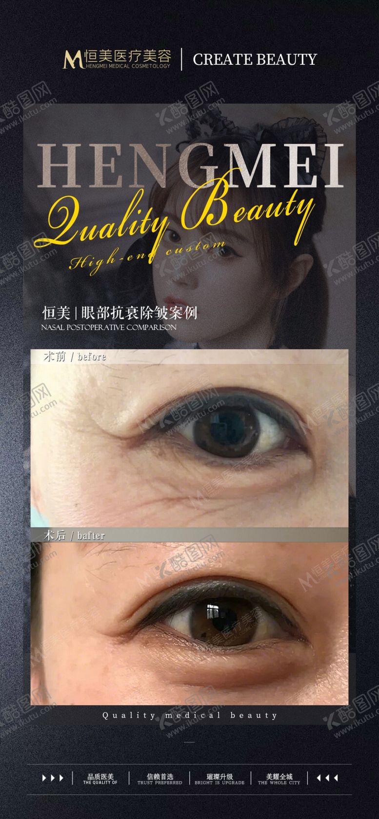 编号：44316101191422518172【酷图网】源文件下载-医美案例对比